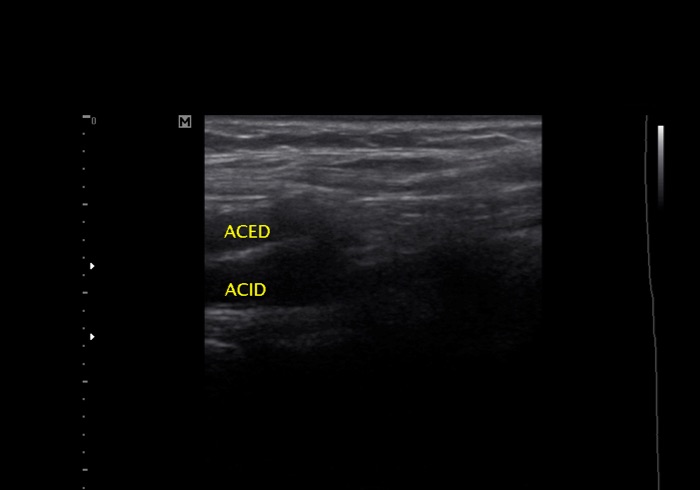 Ecocardiograma 5