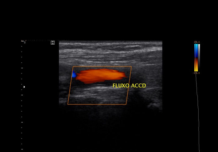 Ecocardiograma 1