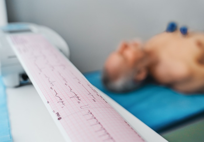 Eletrocardiograma 4