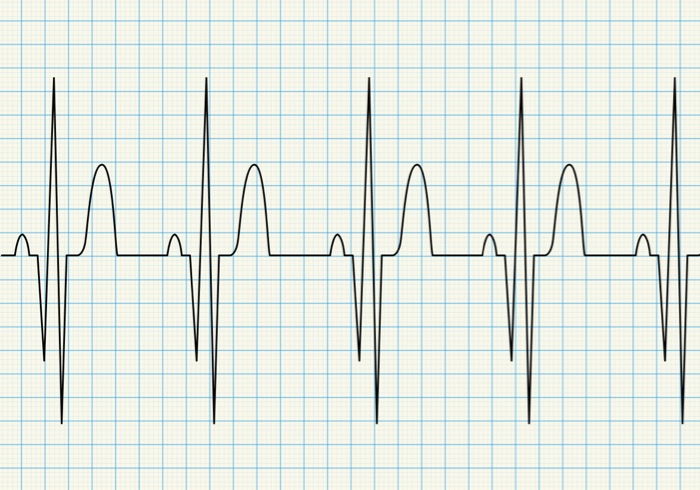 Eletrocardiograma 1